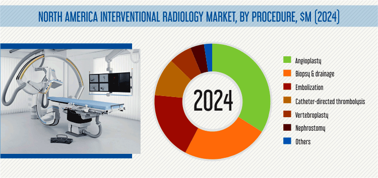 Interventional Radiology Market Geographical Overview