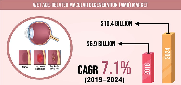 Wet Age Related Macular Degeneration Market