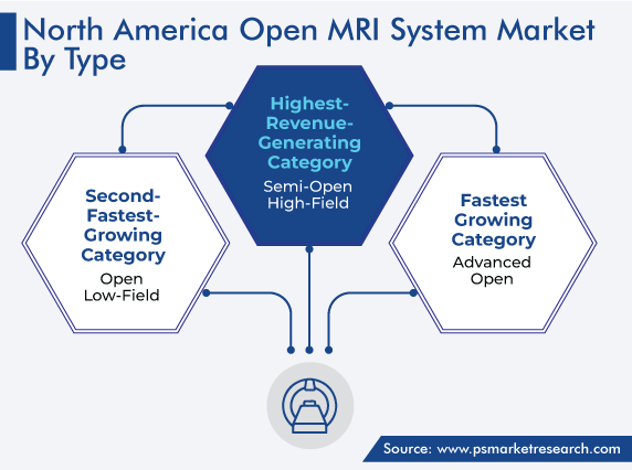 North America Open MRI System Market by Type