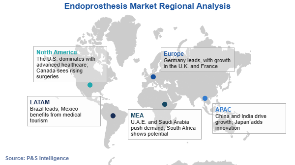 Endoprosthesis Market Regional Analysis